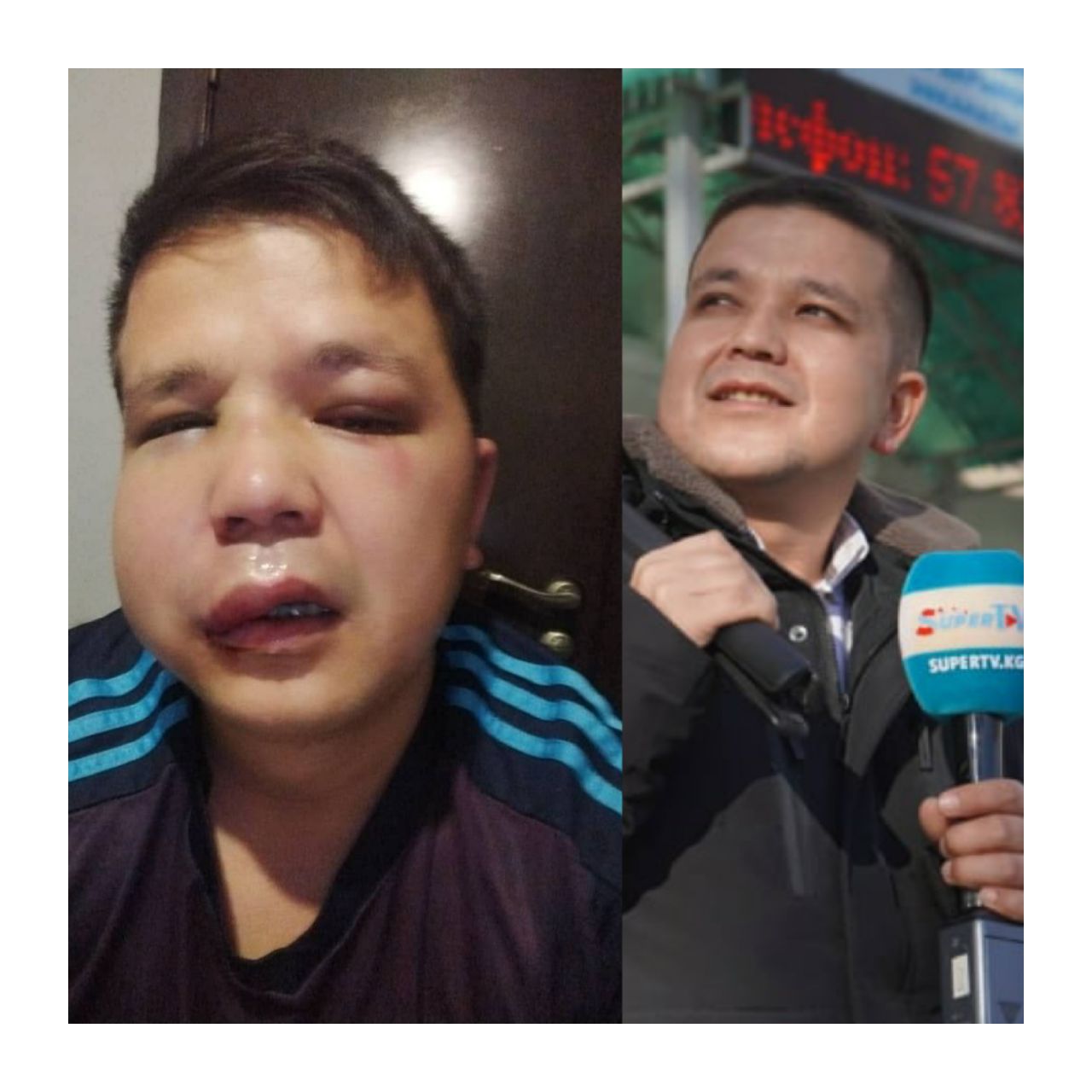 SuperTV'нын кабарчысы сабалды. Кол салуу анын кесиптик ишмердүүлүгүнө байланыштуу болушу мүмкүн