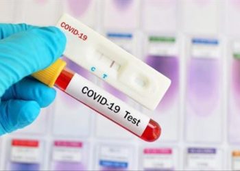 COVID-19 вирусу дагы 3 адамдын өмүрүн алып, 134 адам ооруга чалдыкканы аныкталды