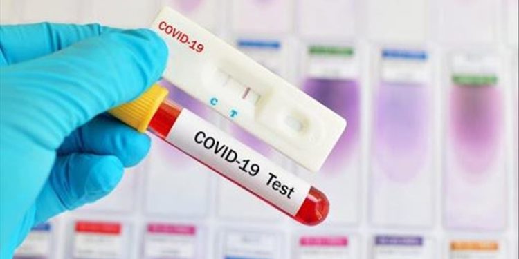 COVID-19 вирусу дагы 3 адамдын өмүрүн алып, 134 адам ооруга чалдыкканы аныкталды