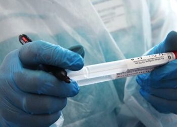 Акыркы суткада өлкөдө 54 адамдан коронавирус аныкталса, 6 бейтап көз жумду