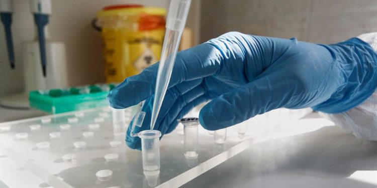 Акыркы суткада өлкөдө 72 адамдан коронавирус аныкталса, 2 бейтап көз жумду