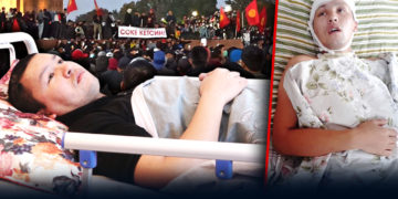 Митингде жабыркаган жаран: «5-октябрда эмне болгону эсимде жок»
