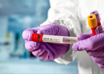 Өлкөдө 882 адам коронавирус менен ооруп жатат. 142 адамдын абалы оор