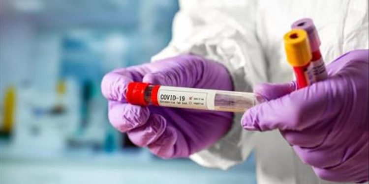 Өлкөдө 882 адам коронавирус менен ооруп жатат. 142 адамдын абалы оор