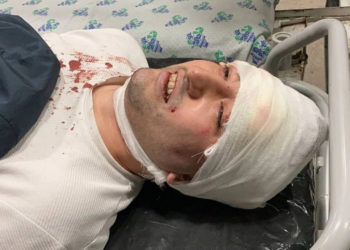 «Абалы оор». Ташкентте ЛГБТ блогерин сабап кетишти