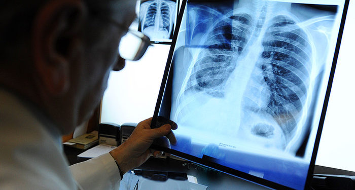 «Шалаакылыктан улам жоокерлер кургак учукка кабылган». Ооруну жугузгандардын саны 26га жетти