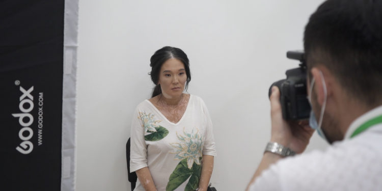 “Бекер жашап тур” деп батир сунуштагандар болду дейт SUPERTV’нын каарманы