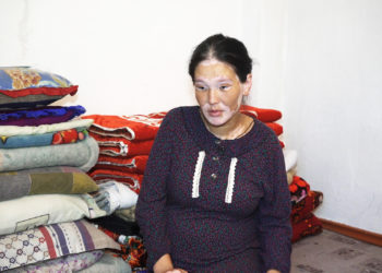 «Күйөөм мени «чаарала», «тиши жок кемпир» деп басынтчу». Ала оорусу менен жабыркаган келиндин тагдыры