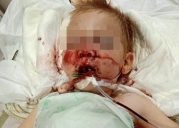 «Бала болбойт, укол менен кармап турабыз дешти». Ивановка айылында 3 жашар бала 3-кабаттан кулап кеткен