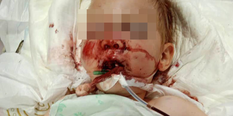 «Бала болбойт, укол менен кармап турабыз дешти». Ивановка айылында 3 жашар бала 3-кабаттан кулап кеткен