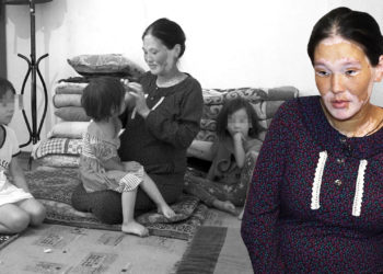 “Ушундай кебетем менен мени бирөө алмак беле” дейт ала оорусу менен ооруган кош бойлуу келин