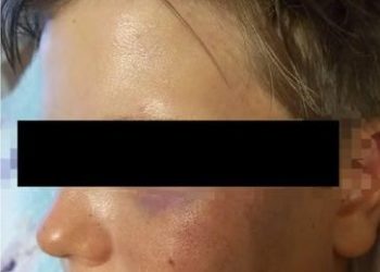 Муфтият Ысык-Көлдөгү машыгуу лагерине барып, сабалган 9 жаштагы өспүрүм боюнча үн катты