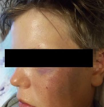 Ысык-Көлдө 9 жашар баланын сабалышы. Окуя Улукбек Мариповдун көзөмөлүндө