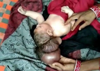 Индияда үч баштуу ымыркай төрөлдү (видео)