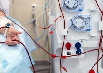 1 миң 753 адам бюджеттин эсебинен гемодиализ алат