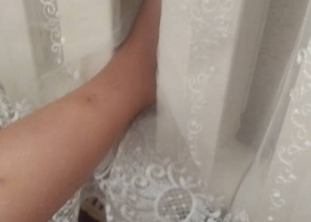 Бишкекте 4 жаштагы кыздын буту батареяга кыпчылып калган