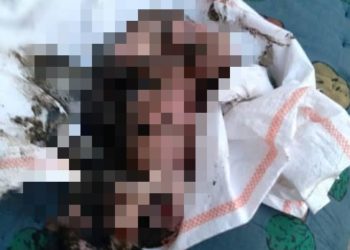 Жалал-Абадда жаңы төрөлгөн ымыркайды дааратканага таштап салышкан. Учурда абалы орто (сүрөт)