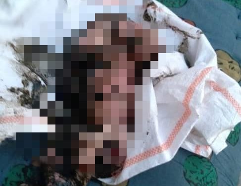 Жалал-Абадда жаңы төрөлгөн ымыркайды дааратканага таштап салышкан. Учурда абалы орто (сүрөт)