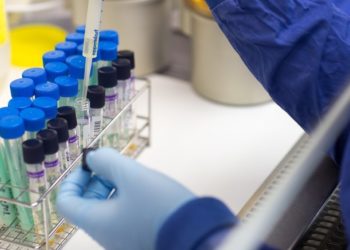 Акыркы суткада 142 адамдан коронавирус аныкталып, 4 киши каза болду. Статистика