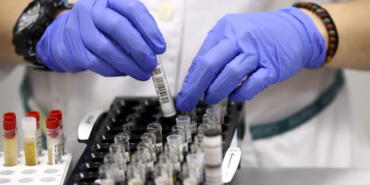 Акыркы суткада 100 адамдан коронавирус аныкталып, 3 киши каза болду. Статистика