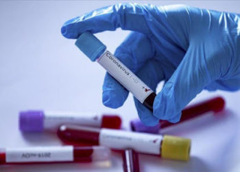 Акыркы суткада 72 адамдан коронавирус аныкталып, 3 киши каза болду. Статистика