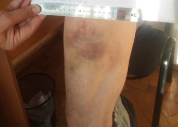 «Таяк менен сексуалдык зомбулук көрсөтөбүз деп…» Ошто 60 жаштагы киши милициядан зомбулук көргөнүн айтты