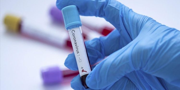 «Каза болгондор катталган жок». Акыркы суткада 76 адамдан коронавирус аныкталды. Статистика