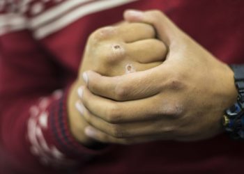 Сокулукта 26 жаштагы жаран сабалды. Кылмышка жаш жигиттер шектелүүдө