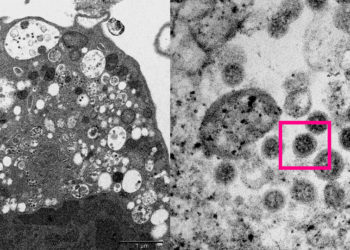 Министр: «Каалайбызбы, каалабайбызбы Кыргызстанга коронавирустун омикрон штаммы келет»