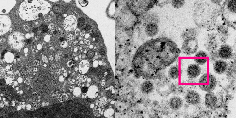 Министр: «Каалайбызбы, каалабайбызбы Кыргызстанга коронавирустун омикрон штаммы келет»