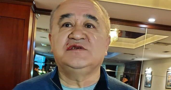 «Сен тажаттың» деп кубалаганы келген элек дешти». Садыр Жапаров Текебаевге болгон кол салуу боюнча үн катты