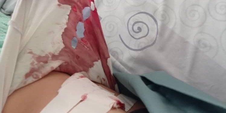 Адвокат: «Жолдошу тарабынан бычакталган келин оор абалда жатат»