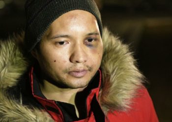 «Силер мен эмнени көргөнүмдү билбейсиңер». Казакстанда кармалган Кыргыз музыканты билдирүүсүнө түшүндүрмө берип, алган жаракаттары тууралуу айтып берди