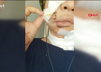 Кыргыз кызынын Стамбулдагы мейманканада бети жана моюну кескиленген абалда табылышы. Ишти консулдук көзөмөлгө алды