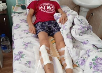 Алматыда жаракат алган кыргызстандык Чолпонбек Сыдыков жардамга муктаж