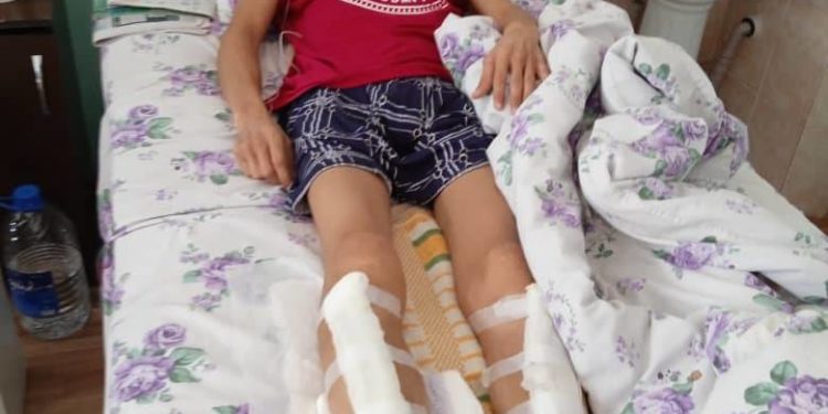 Алматыда жаракат алган кыргызстандык Чолпонбек Сыдыков жардамга муктаж