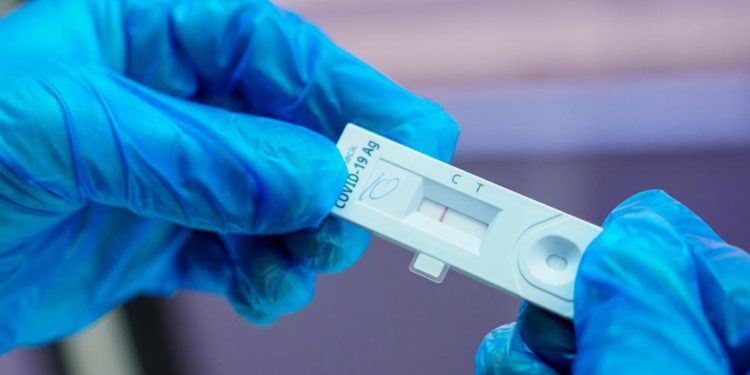 «Жыйынтыгы 5 мүнөттө даяр болот». Кыргызстандын дарыканаларында коронавируска экспресс-тесттер сатыла баштайт