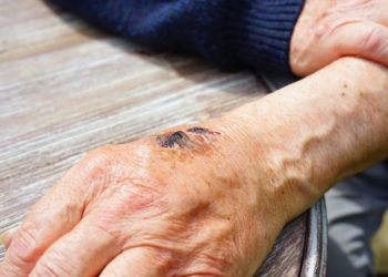 Нарында күйдүргү катталдыбы? Министрликтин жообу