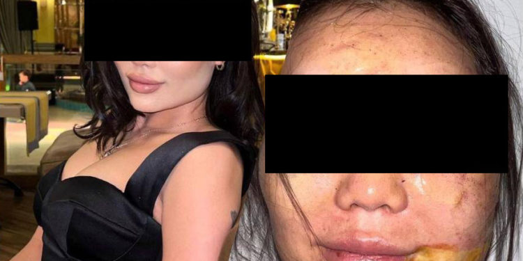 Аялын аёосуз сабаган жаран изделүүдө. Ал — чет өлкөлүк жаран