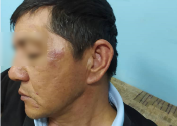 Чүйдүн тургуну милиция тарабынан сабалганын айтып чыкты. Милиция бул боюнча эмне дейт?