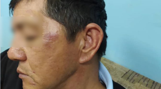 Чүйдүн тургуну милиция тарабынан сабалганын айтып чыкты. Милиция бул боюнча эмне дейт?