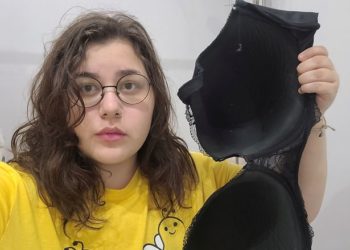 11-өлчөм. 22 жаштагы кыз 13 килограммдык эмчегинин азабын тартып келет