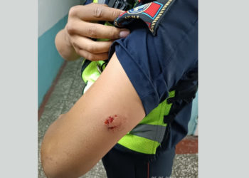 «Баласы балдарды кабыл алуу бөлүмүндө». Ошто 21 жаштагы мас абалындагы келин кайгуулчунун колун тиштеп салган