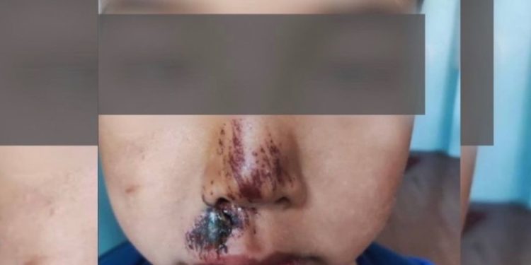 Эне Беловодское айылындагы интернатта уулу сабалганын айтып чыкты