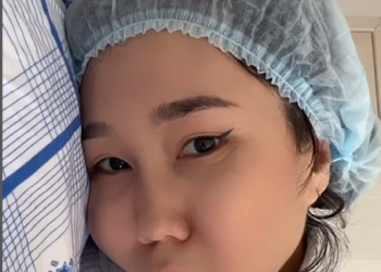 «Көп жыл чыдап жүрдүм». Ырчы Каныкейге операция жасалды