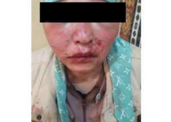 Ысык-Көлдө көгала болуп сабалган келин. Акыйкатчы институту прокуратурага кайрылганын билдирди