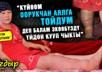 “Күйөөм оорукчан аялга тойдум деп балам экөөбүздү үйдөн кууп чыкты. Бир бутум 20 килограмм” | Тагдыр