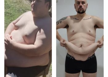 Тандоо ар кимде бар! Австралиялык тургун тез татымдан семирип, төшөккө жатып калган