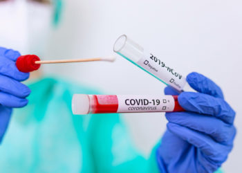 Орусияга уча тургандар ПЦР-тест тапшырышат. Республикалык штаб маалыматты тактады