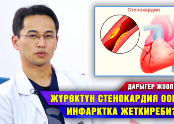 Жүрөктүн стенокардия оорусу инфарктка жеткиреби? Дарыгер жооп берет
